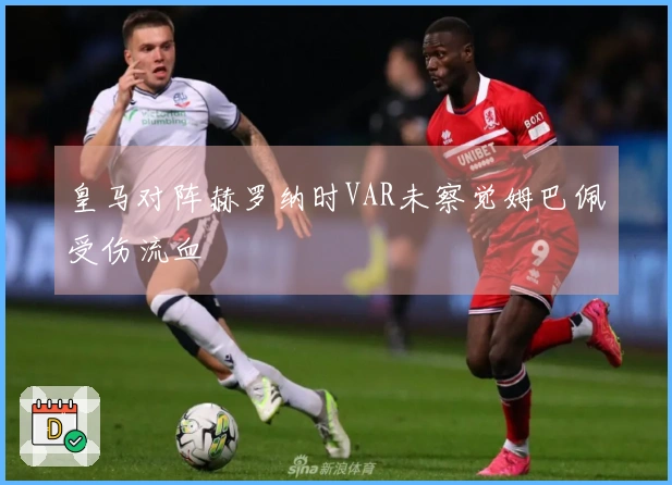 皇马对阵赫罗纳时VAR未察觉姆巴佩受伤流血