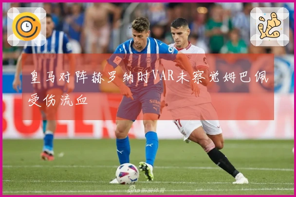 皇马对阵赫罗纳时VAR未察觉姆巴佩受伤流血
